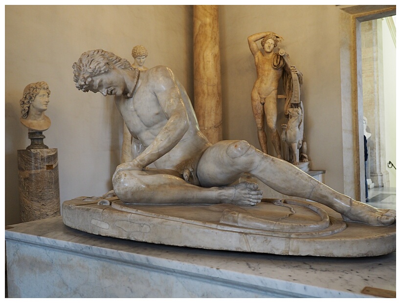 Dying Gaul