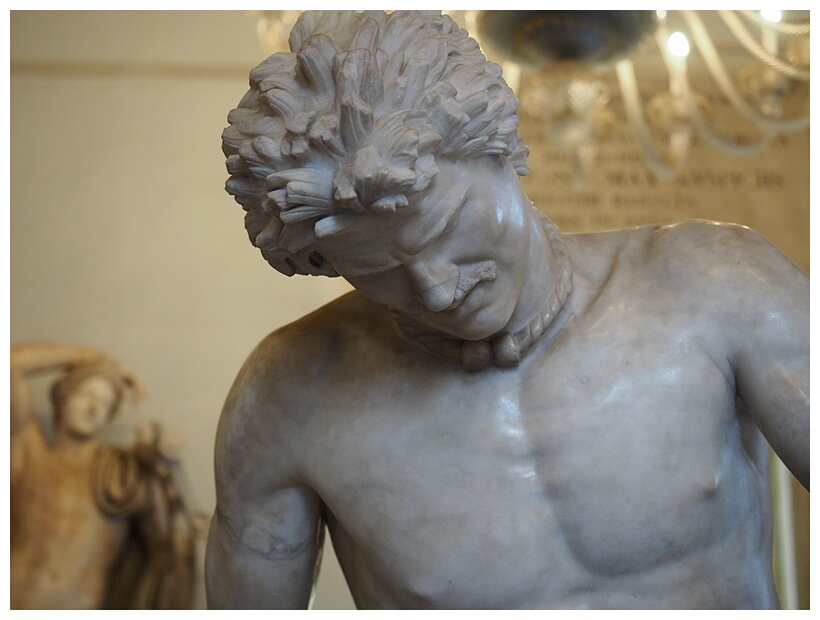 Dying Gaul